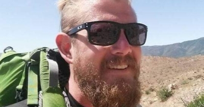 Man Burned His Thumb While Cooking And Then Learned Both Of His Legs Had To Be Amputated