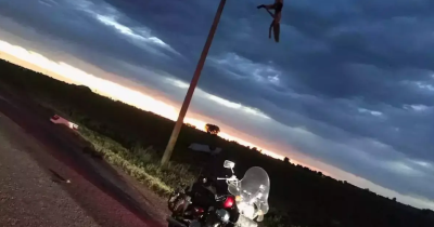 Teen Left Hanging From Power Line By Broken Leg After Car Crash Shares Stark New Images Five Years Later