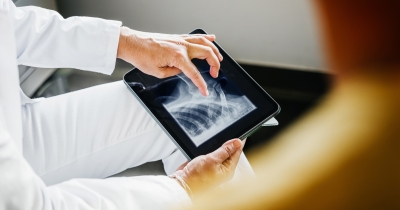 Doctor Explains Why Some People Have Never Broken A Bone Despite Bizarre Online Theories