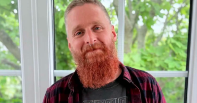 Man's Vape Battery Exploded In His Pocket And Left Him Needing A Skin Graft