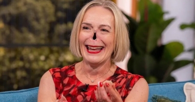 A Dog Accident Exposed The Rare Illness That Changed Jayne Hardman's Face For Years