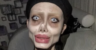 Woman Dubbed 'Zombie Angelina Jolie' Looked Very Different When She Finally Appeared On TV